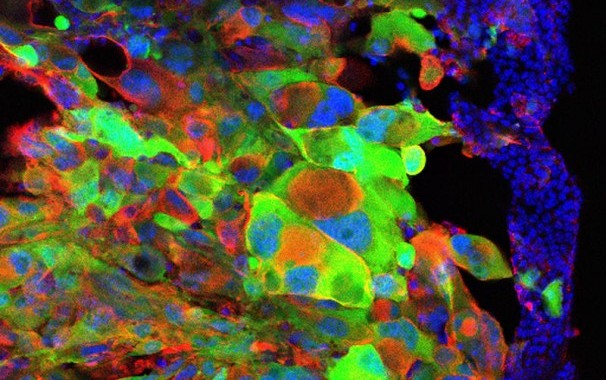 Imagen: Eric Bushong.